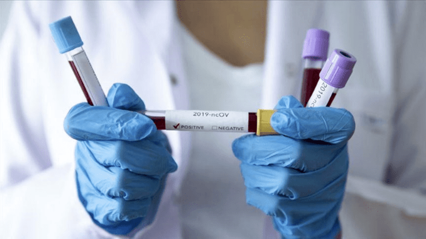 Коронавірус у світі — Україна на 25 місці за поширенням коронавірусу