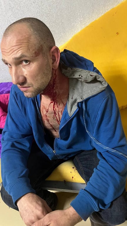 Харьковчанин в крови успел сфотографировать следы издевательств в Самборском ТЦК