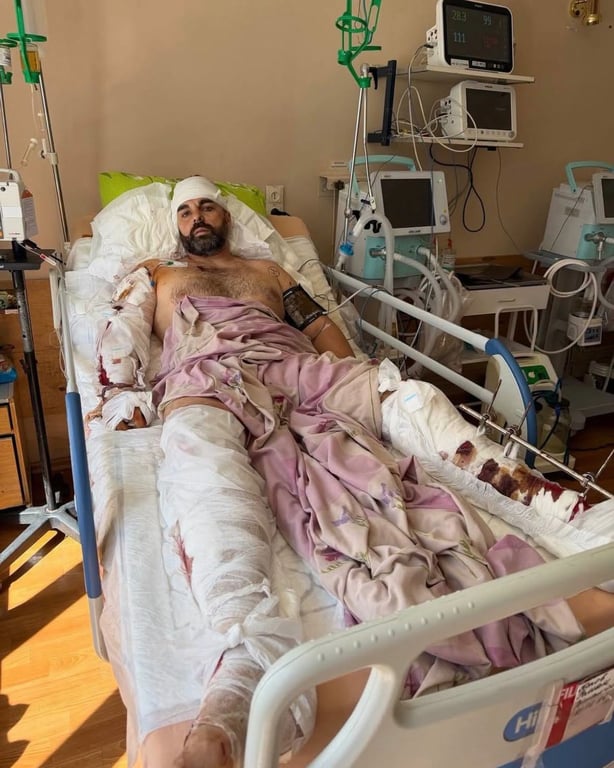 В результате атаки на Кривой Рог пострадал функционер Кривбасса