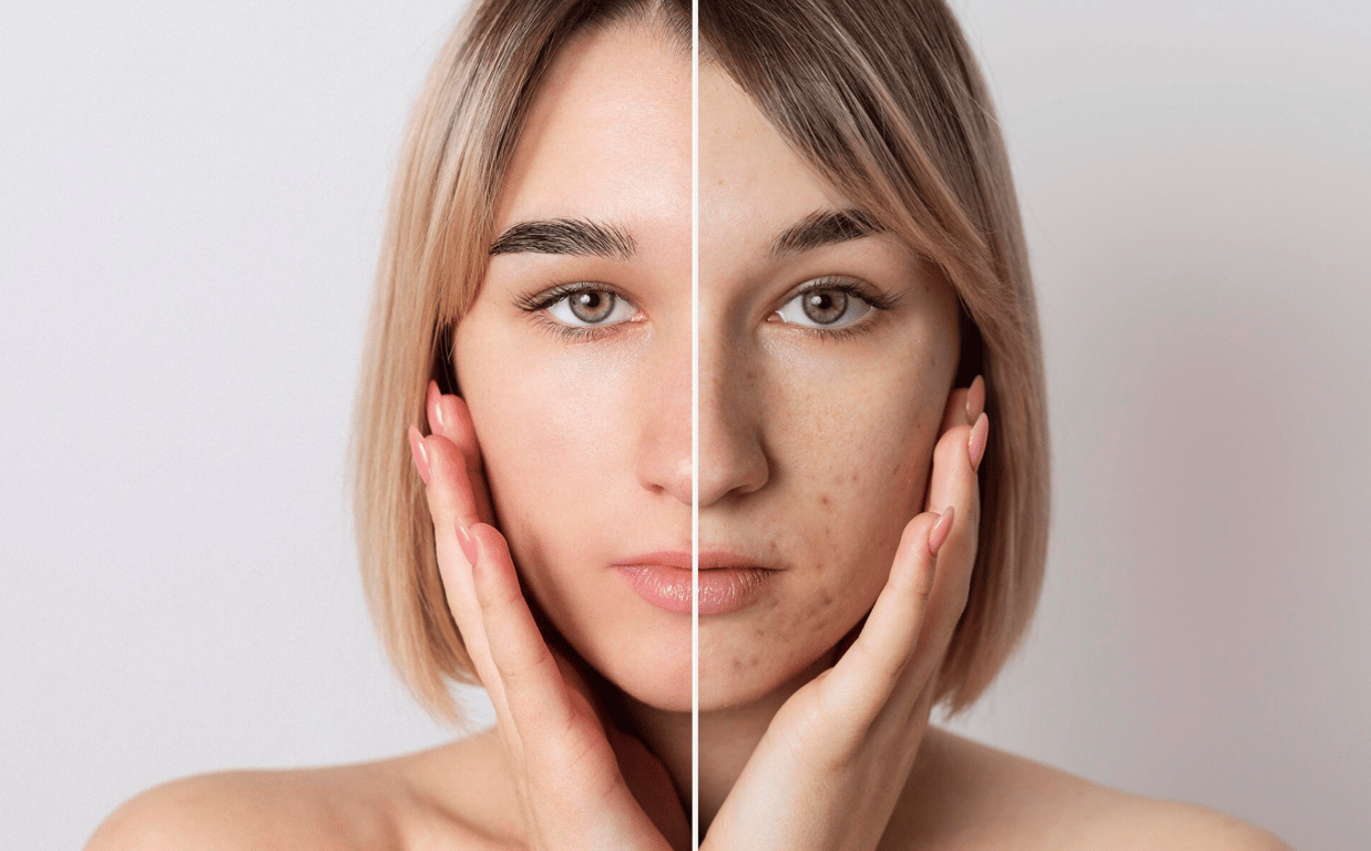 Догляд за шкірою дуже важливий для кожної жінки