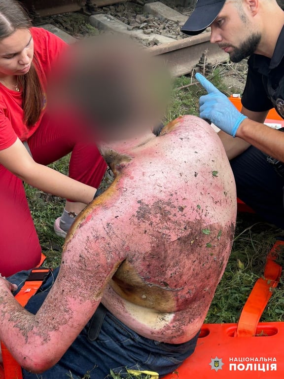 Робили селфі — в Одесі двоє підлітків отримали електричний удар на залізниці - фото 1