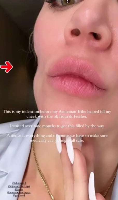 Хлої Кардаш'ян показала зміни у зовнішності