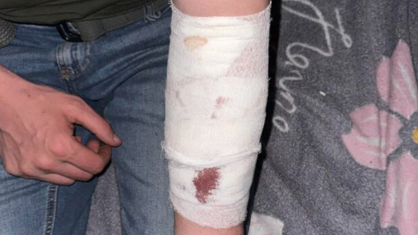 Мужчина порезал вены в ТЦК в Закарпатье — подробности инцидента