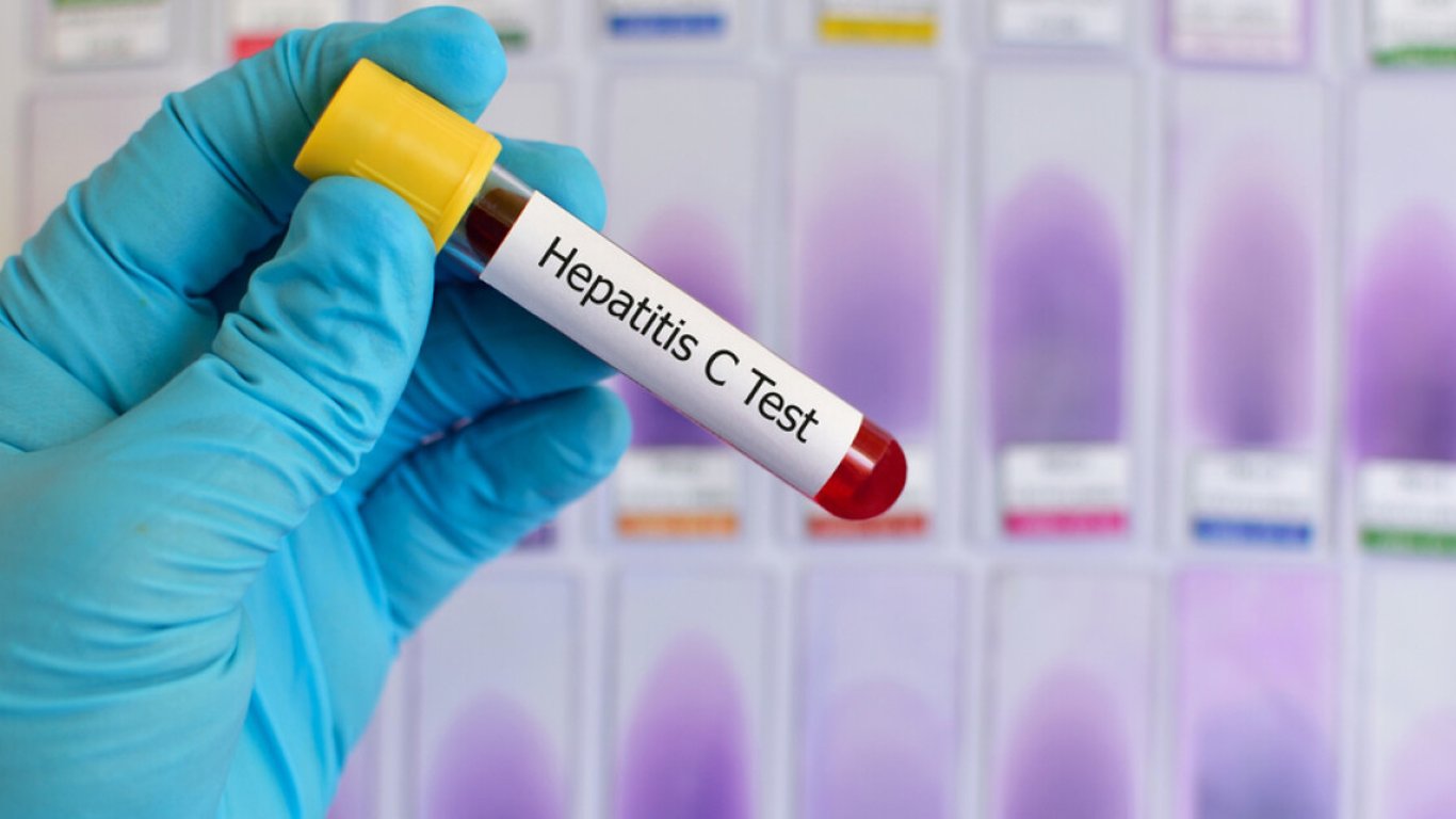 Лише 3% хворих на гепатит С на Одещині отримують лікування