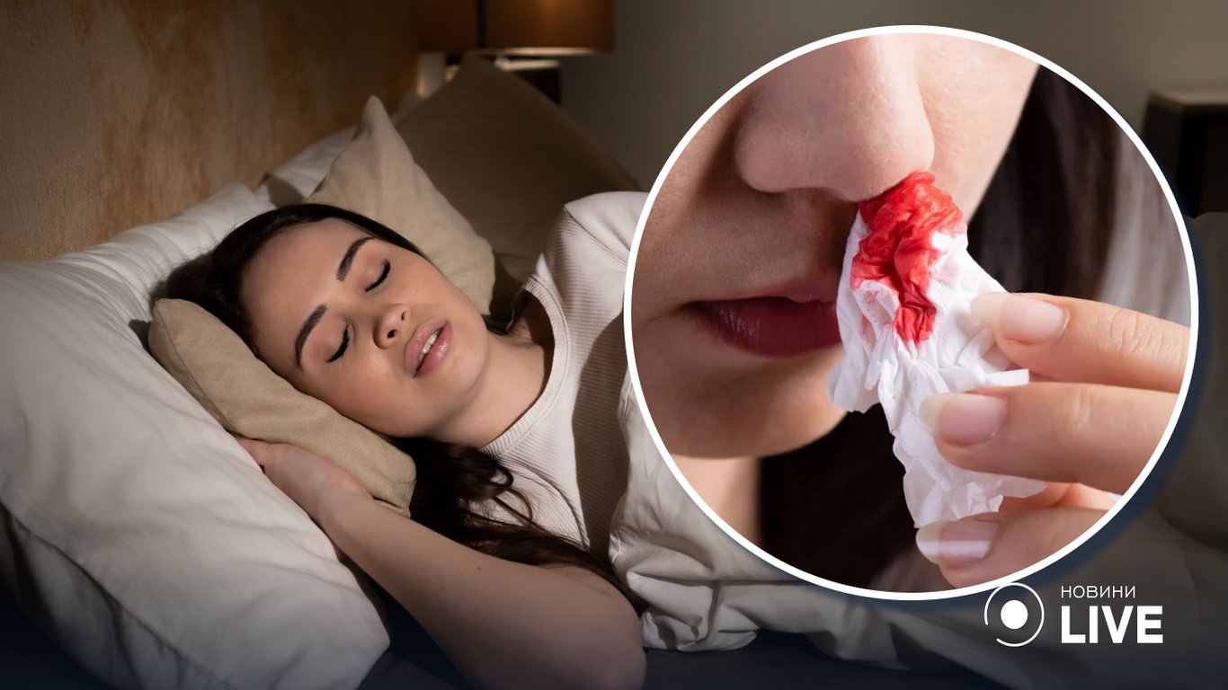 Почему снится кровотечение из носа – толкование по разным сонникам