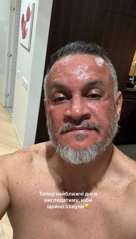 Эктор Хименес-Браво сделал омоложение