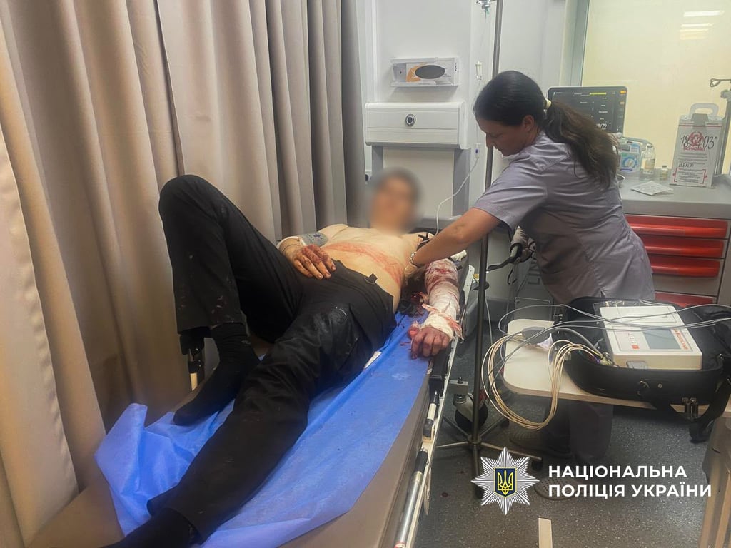 У Запоріжжі чоловік з ножем поранив трьох поліцейських під час обшуку - фото 1