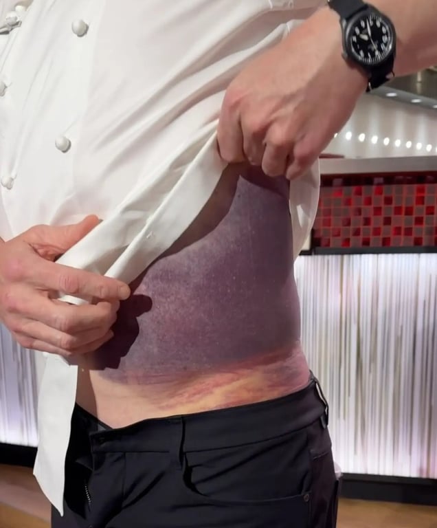 Шеф-повар Гордон Рамзи поделился деталями аварии на велосипеде, в которой серьезно травмировался - фото 3