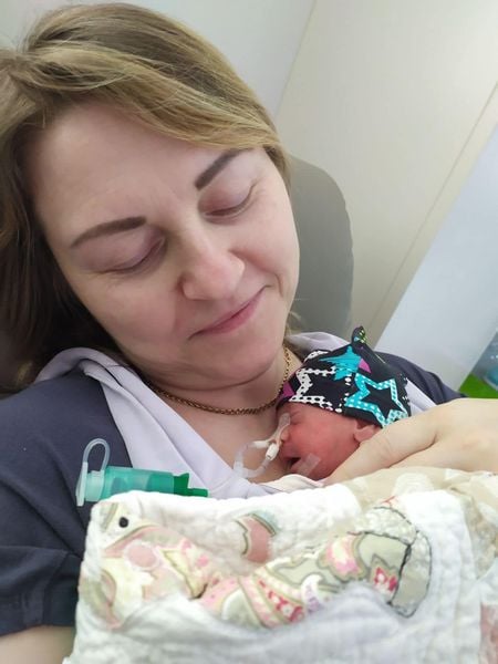 У Львові врятували хлопчика, який народився з вагою менше кілограма - фото 1