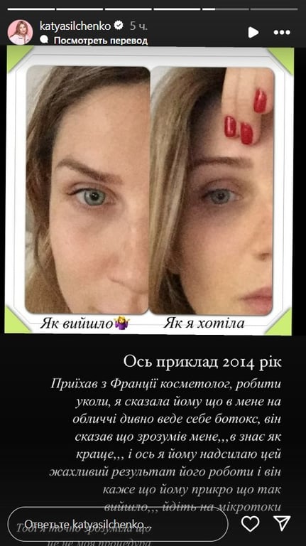 Сільченко відмовилась від ботоксу