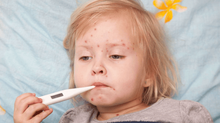 У МОЗ попередили українців про необхідність щеплення дітей від важкої хвороби - 285x160
