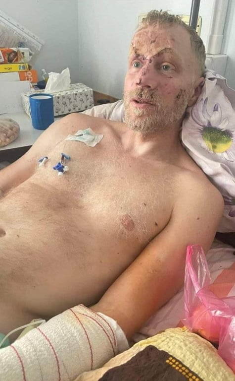 Андрей Валенский был ранен на войне