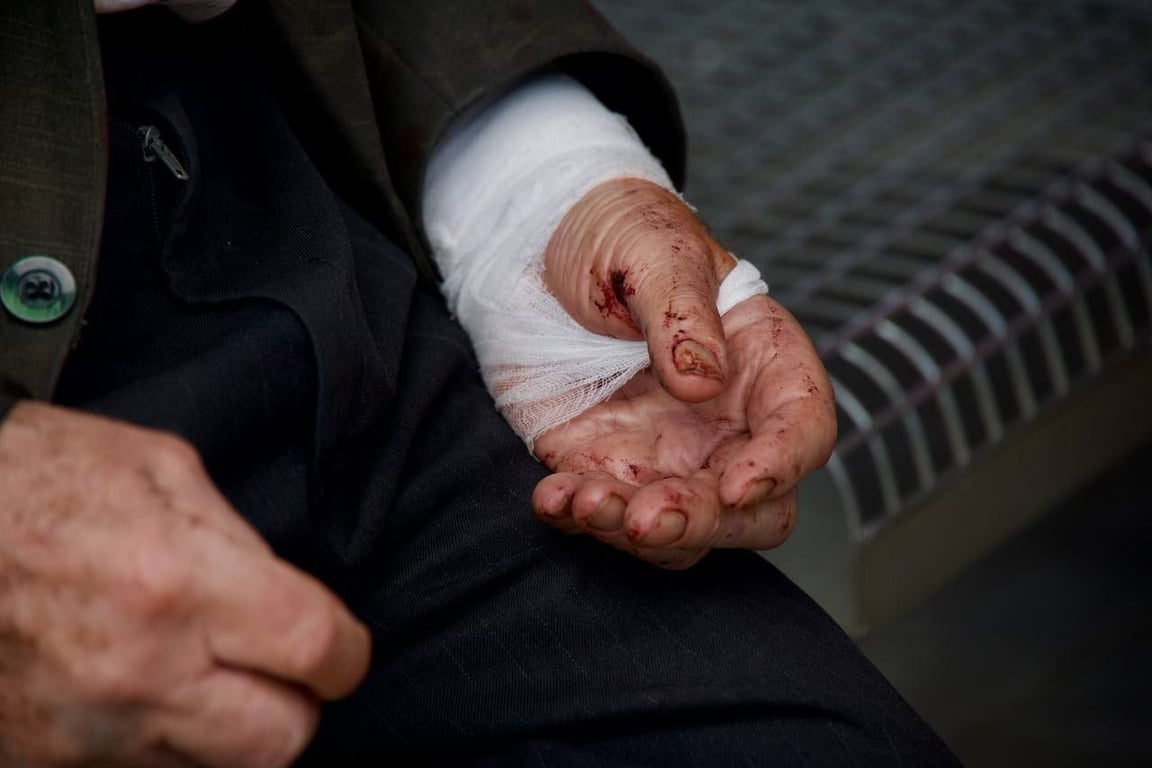 Поранена людина внаслідок обстрілу Дніпа 3 липня