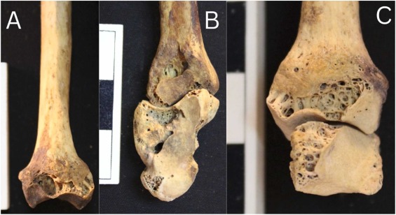 В 3500-летнем скелете обнаружили страшную болезнь - что говорят ученые