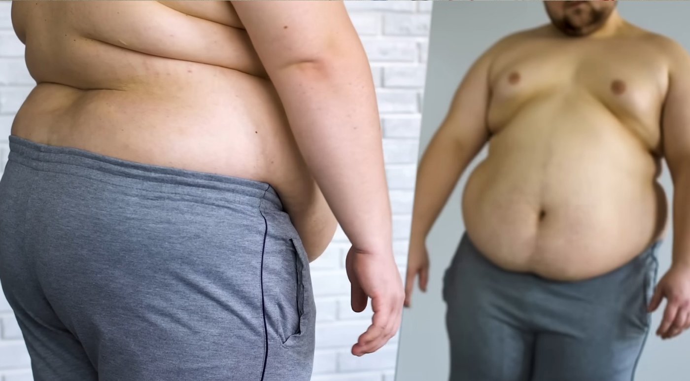 Пивной живот