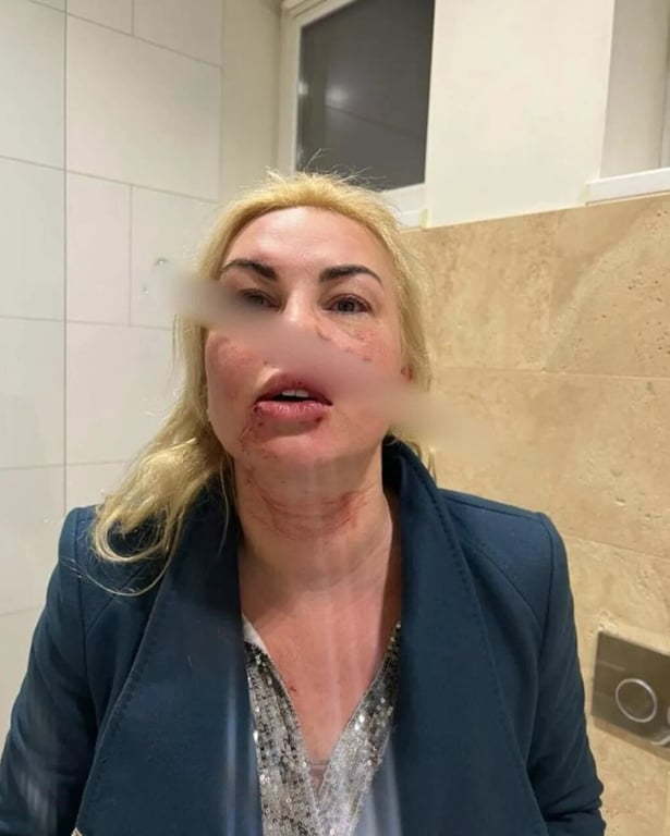 Камалія побої