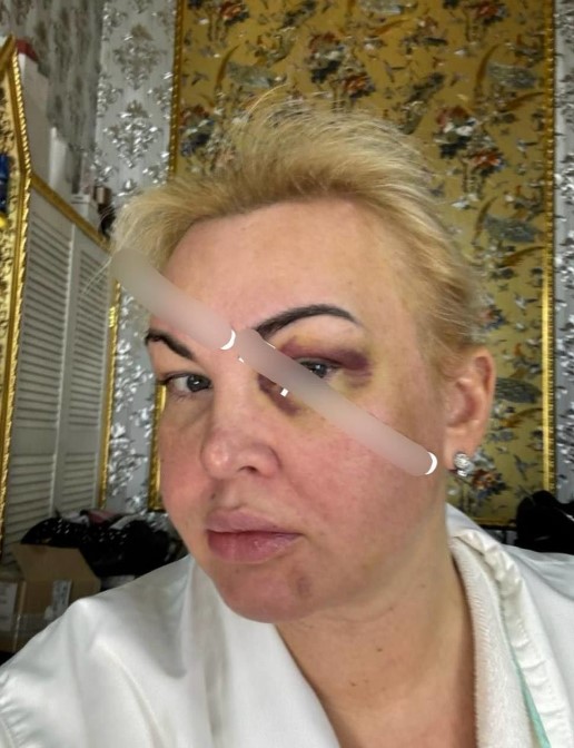 Камалія страждає від домашнього насильства