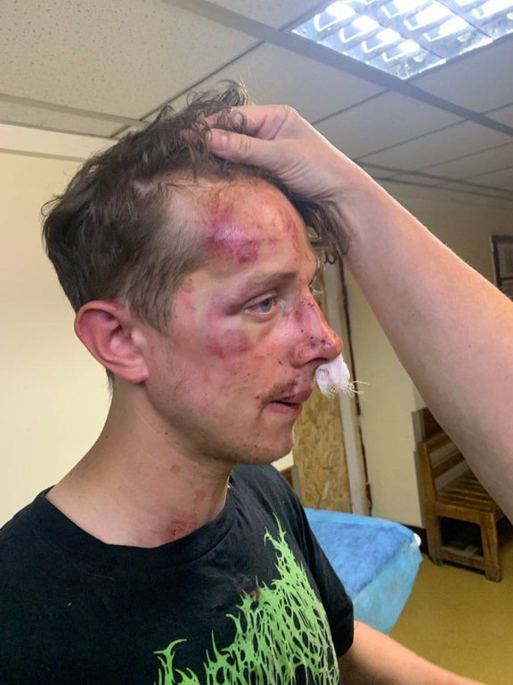 Побиття ветерана війни у Києві