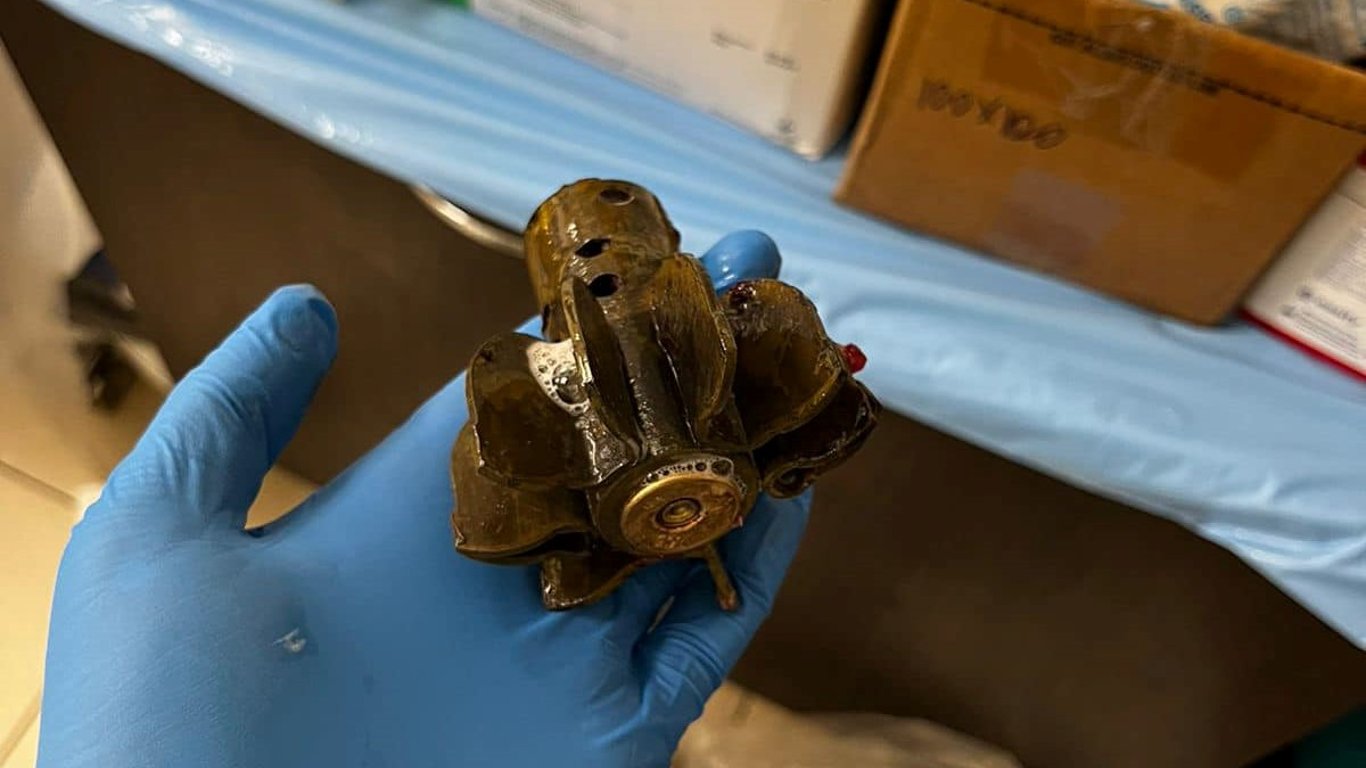 Військові медики дістали з тіла воїна ЗСУ хвостовик міни