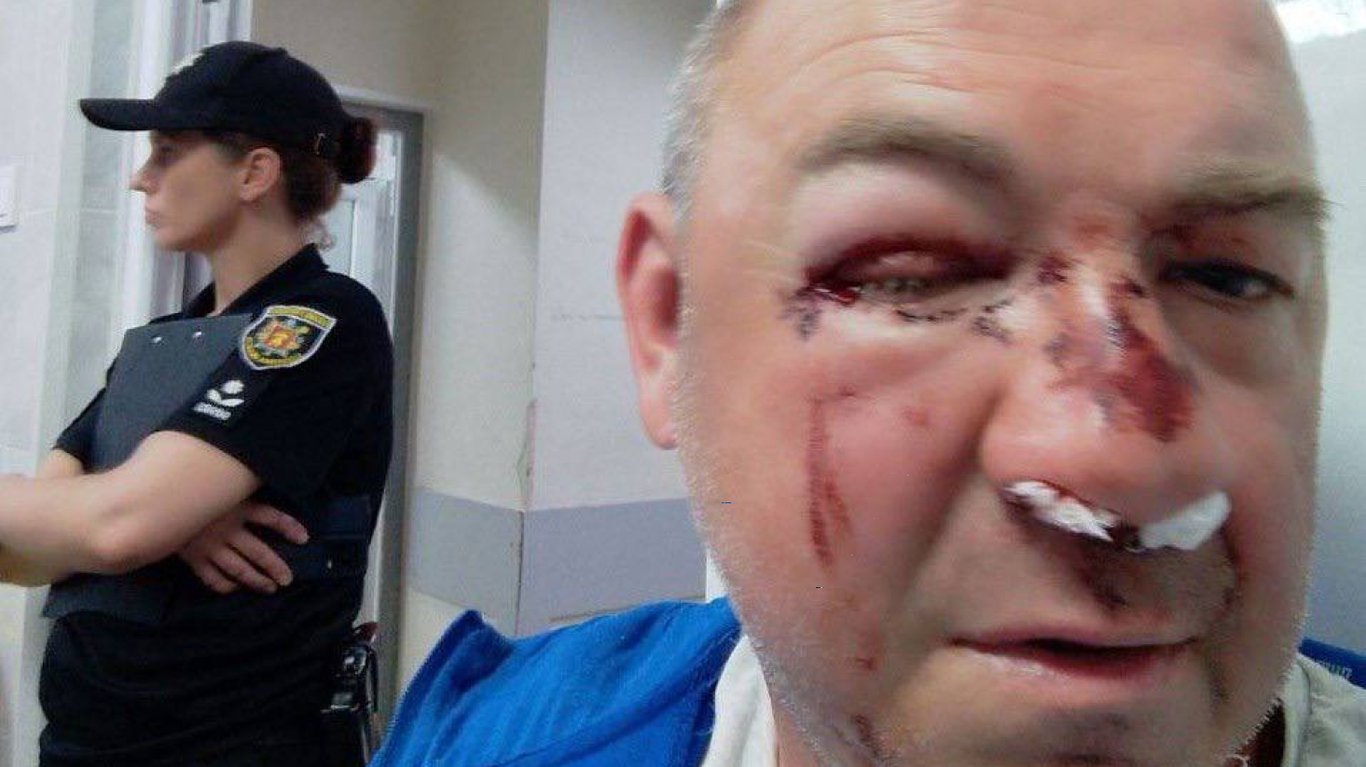 Батько постраждалого підлітка