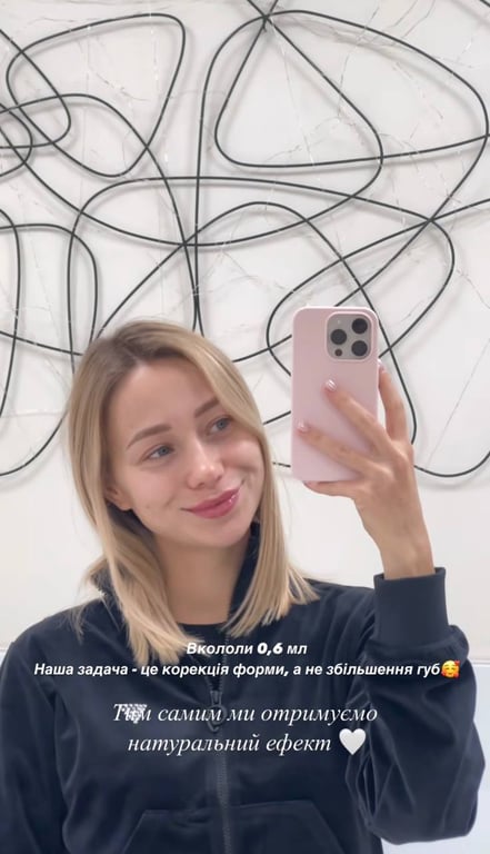 Жена Виктора Павлика изменила форму губ