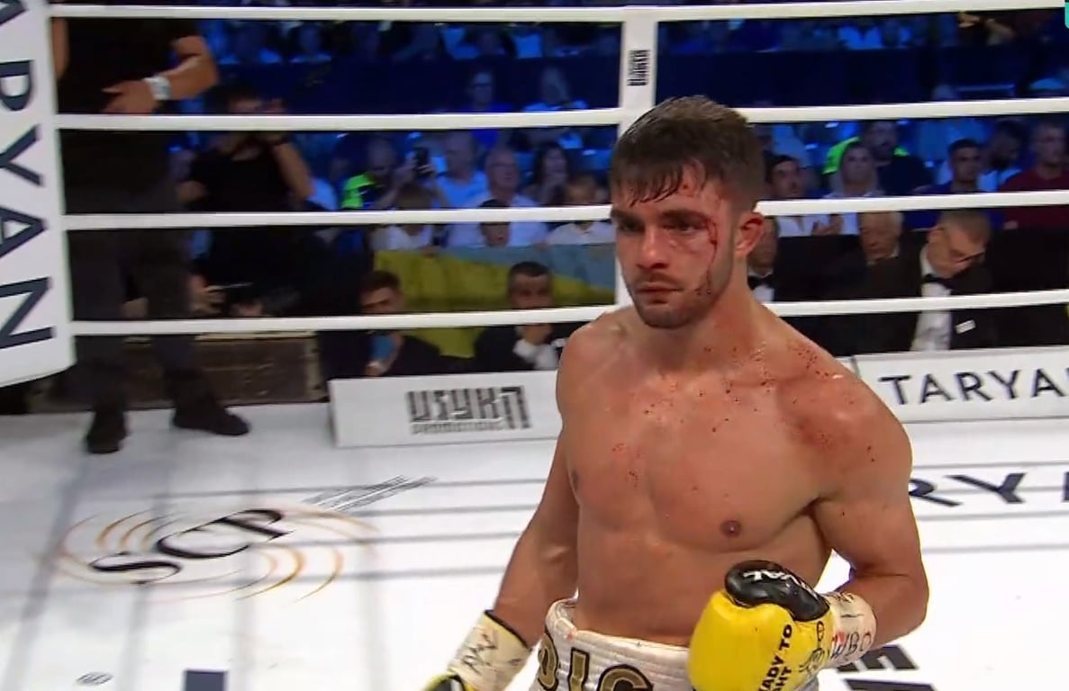 Энтони Игит