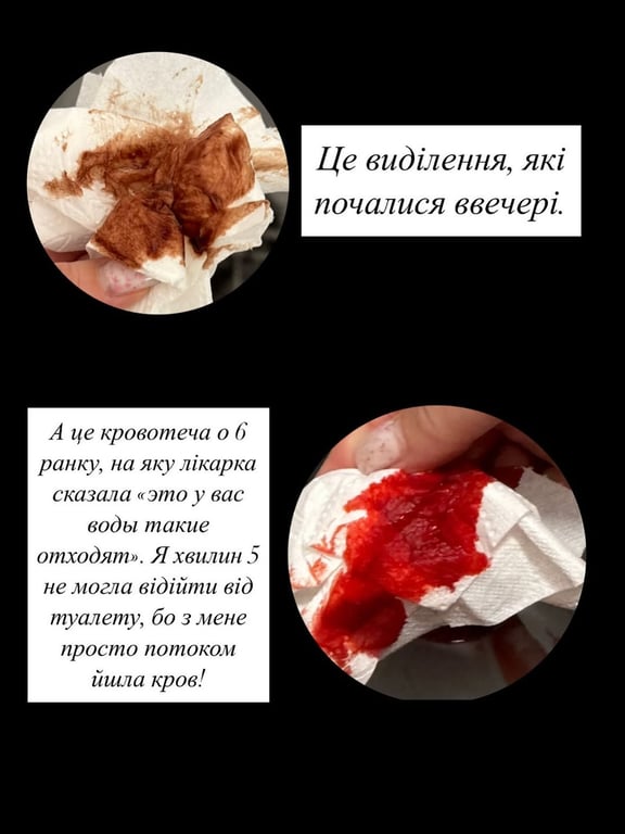 Одеса смерть дитини пологовий 5