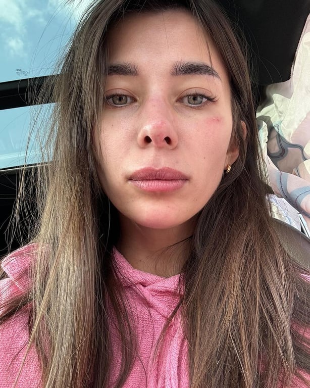 Не впоралася із кермуванням на швидкості — зірка шоу "Холостяк" ледь не загинула у ДТП - фото 1