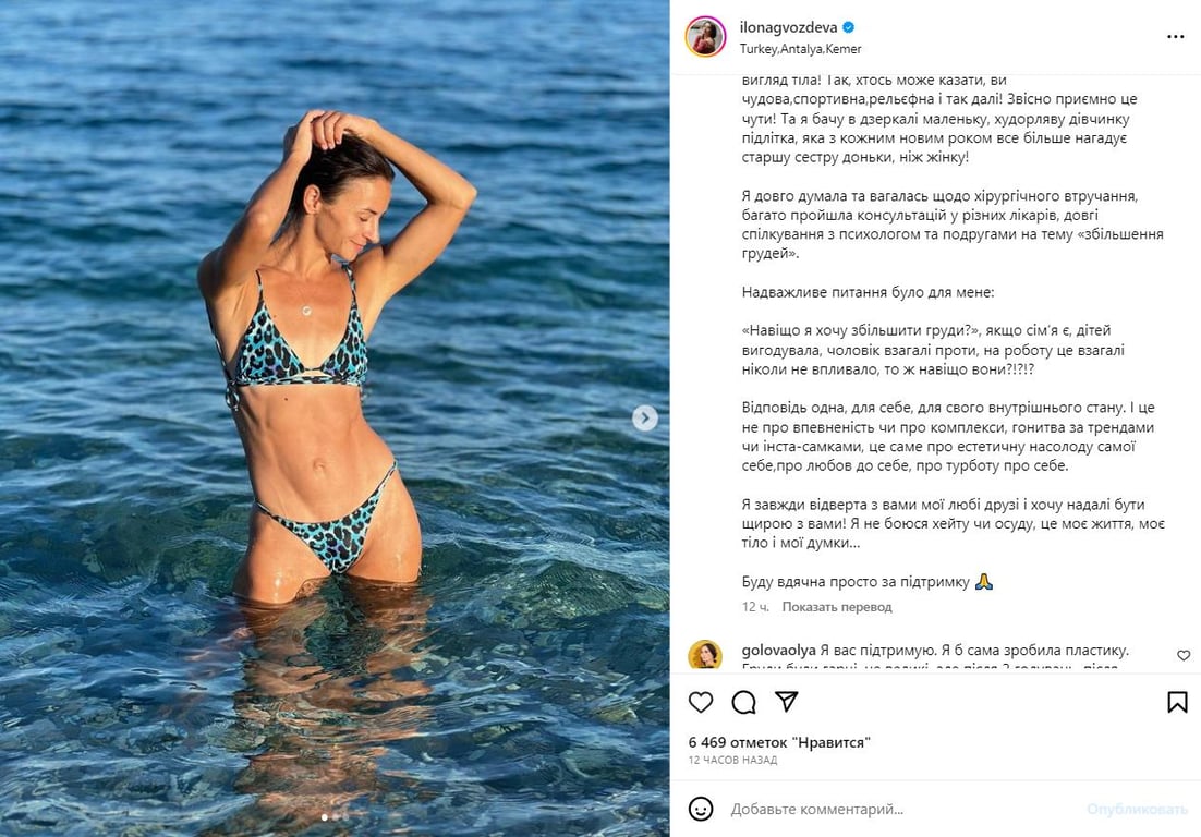 "Хочу знову відчувати себе жінкою": Ілона Гвоздьова зібралася збільшити груди - фото 1