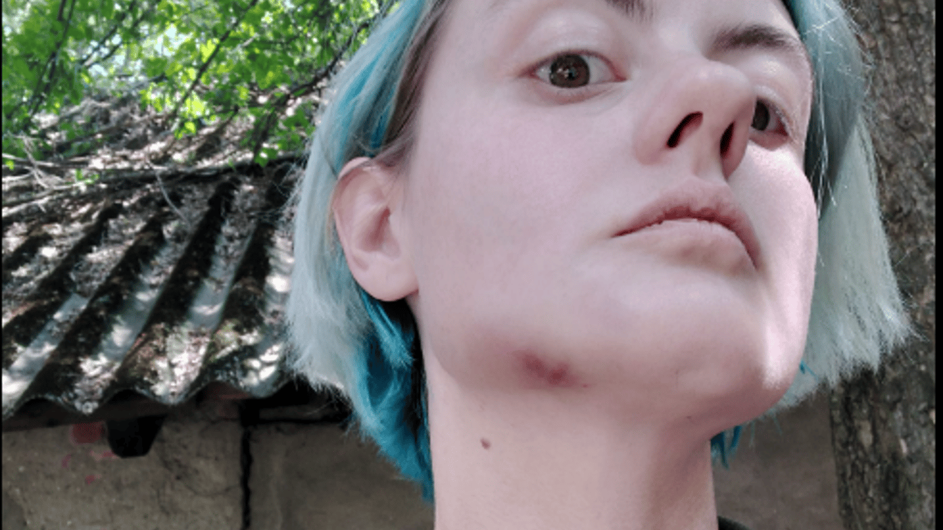 Старший офіцер Закарпатського ОВК жорстоко побив жінку: чи буде покарання