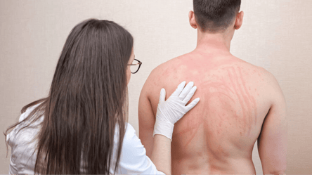 Если призывник страдает дерматитом: мобилизуют ли с болезнями кожи во время войны - 285x160