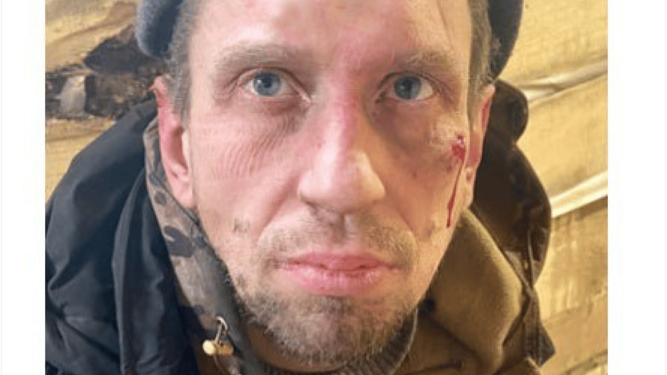 In Kursk region, Ukrainian troops capture an occupier who witnessed the execution of Ukrainian soldiers