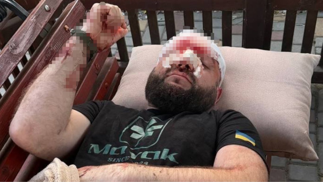 Зауваження через російську музику: на Одещині побили військового