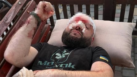 Зауваження через російську музику: на Одещині побили військового - 290x166