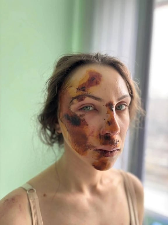 Жінку військового збило авто, слідчі не визнають її потерпілою