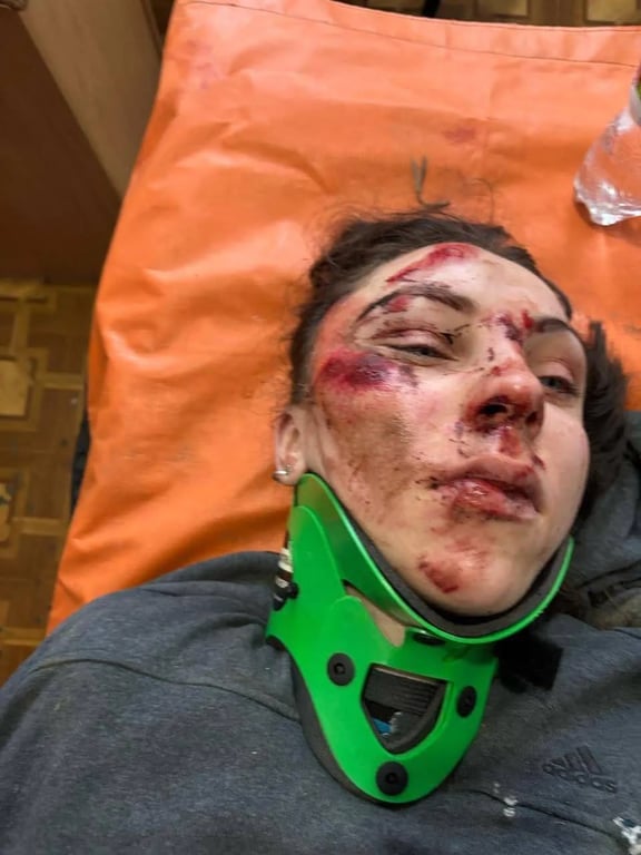 Не визнають потерпілою жінку, яку збило авто на Рівненщині