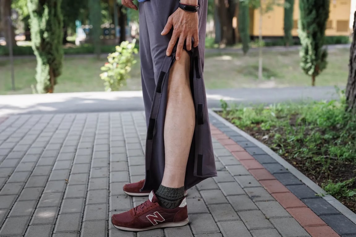 Міноборони закупить "пакунки пораненого" — що в них входитиме - фото 1