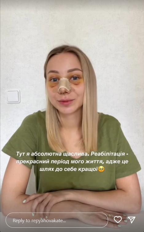 Життя "до" та "після": дружина Віктора Павліка розповіла, чи не жалкує про пластичну операцію - фото 2