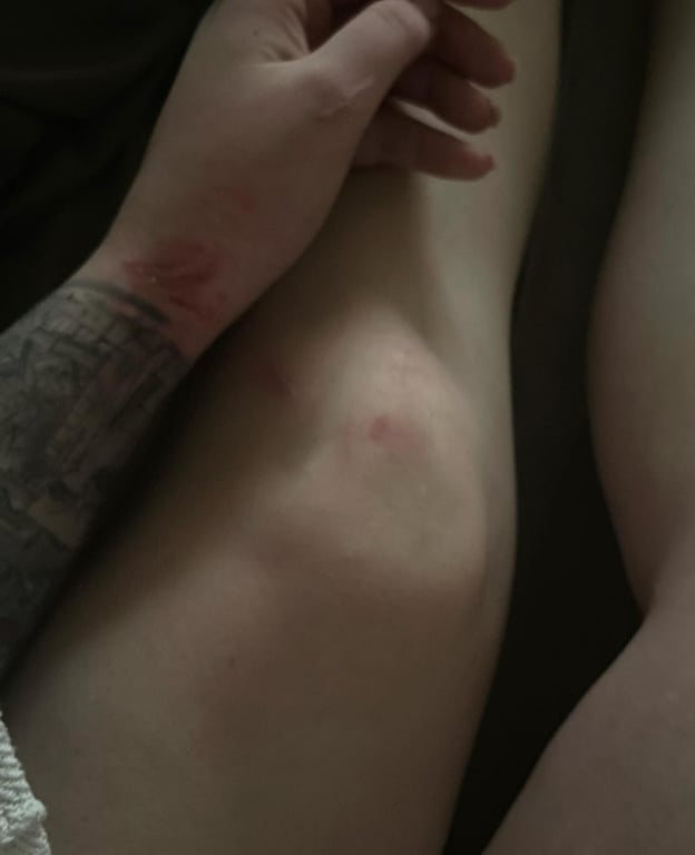 Пташка потрапила в аварію