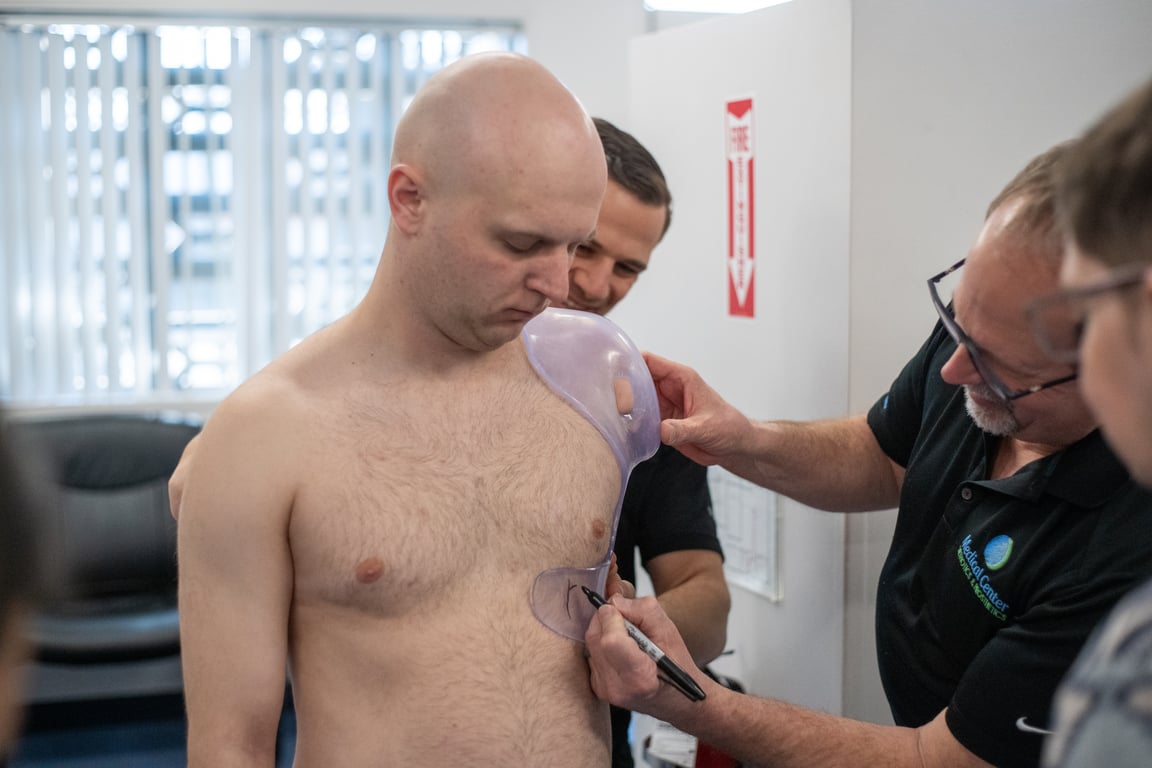 протезирование руки военного