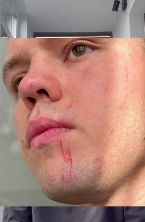 Скуратов прокомментировал побои