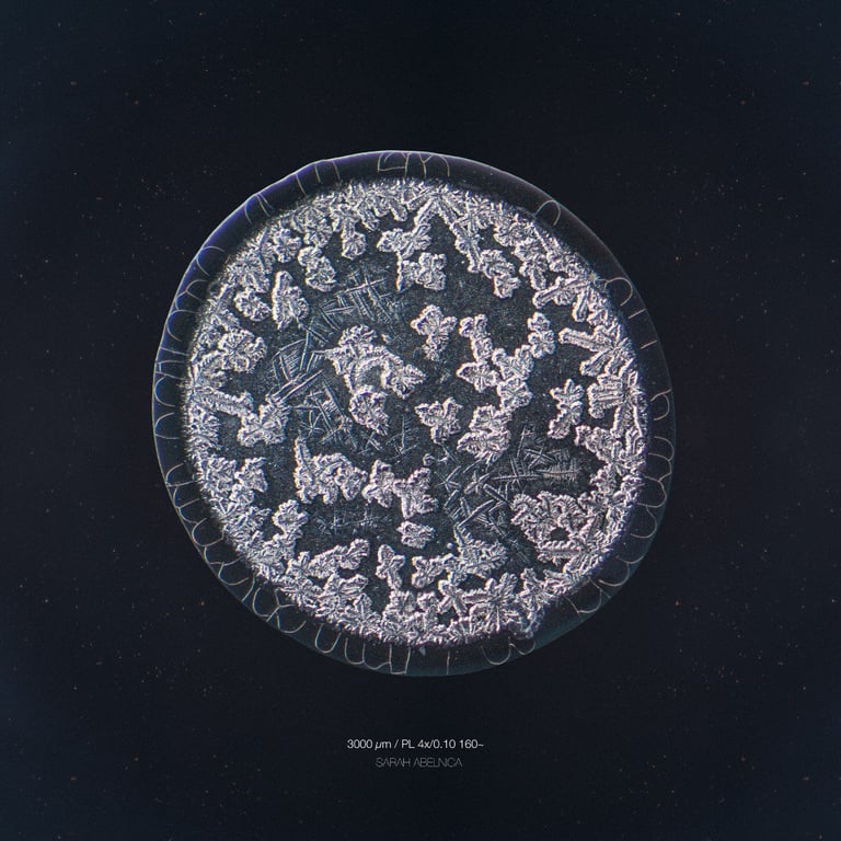 Вот удивительные фотоснимки человеческих слез под микроскопом