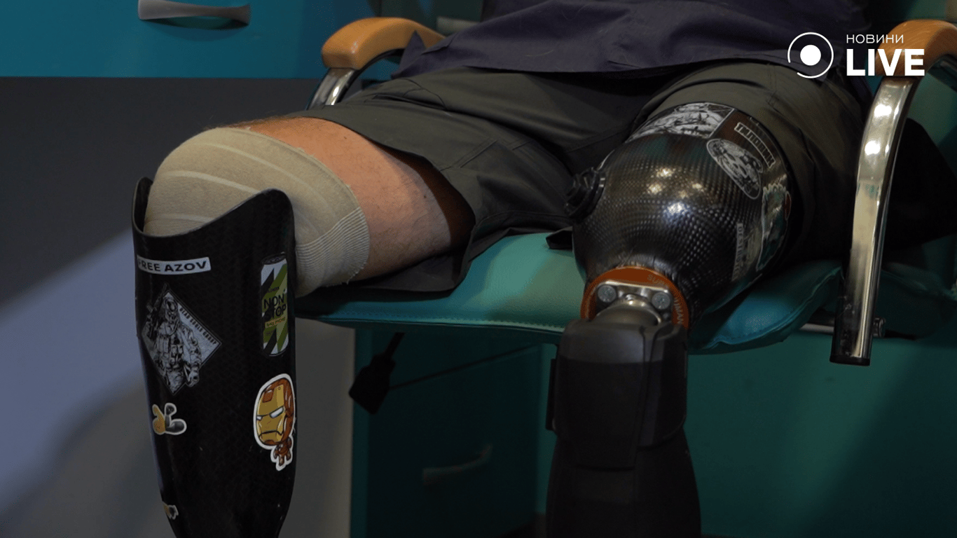 Олексій Притула на протезах. Фото: Новини.LIVE