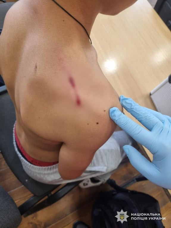 Дев'ятикласник поранив однокласника з травматичного пістолету