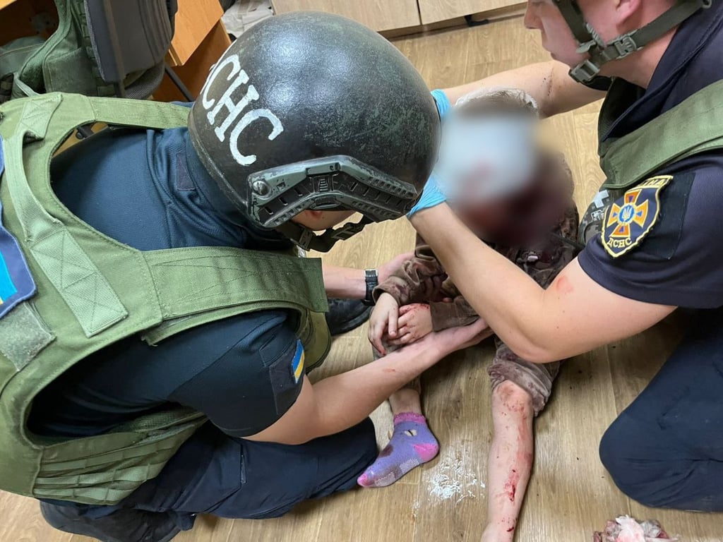 Поранена дитина у Нікополі 21 вересня