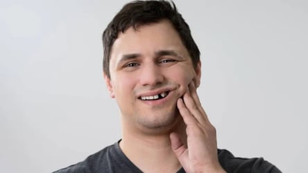 Мобилизация в Украине — могут ли призвать, если больные зубы - 285x160