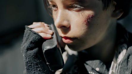 На Одещині у автокатастрофі загинув 13-річний хлопець: ще одна дитина в реанімації. Фото - 285x160