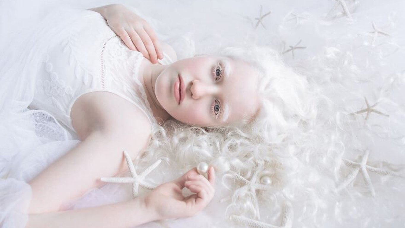13 июня: праздники, приметы и День распространения информации об альбинизме