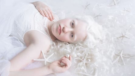 13 июня: праздники, приметы и День распространения информации об альбинизме - 285x160