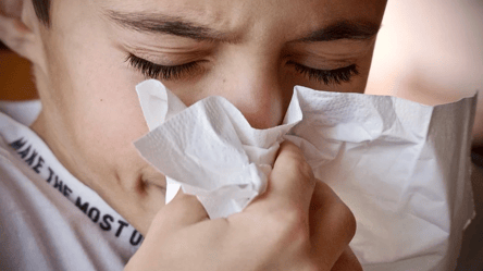Як відрізнити алергію від застуди: експерт Kyiv LIVE дав відповідь - 285x160